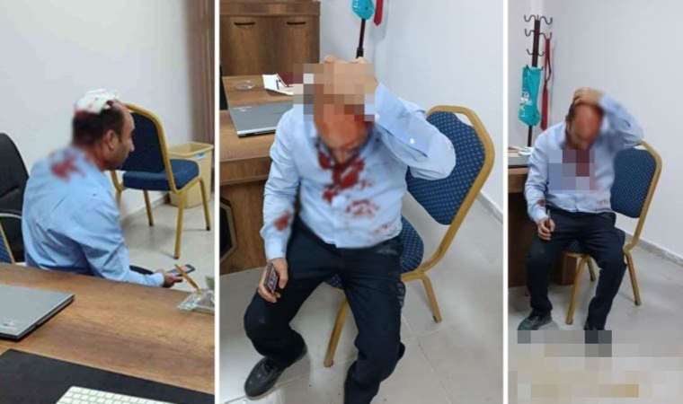 Şanlıurfa’da okul müdürü ‘demir sopalı’ saldırıya uğradı