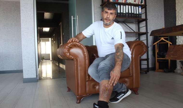 Bacağında unutulan bez parçasıyla 16 yıl yaşadı!