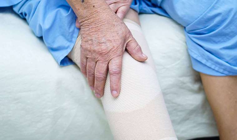 Diz protezi sonrası rehabilitasyon iyileşmede hayati önem taşıyor!