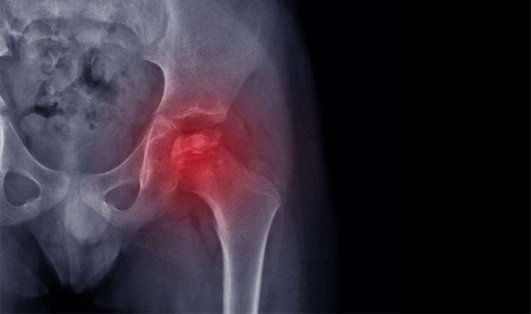 Çocuğunuzda büyüme ağrısı sandığınız ağrılar başka hastalıklar olabilir