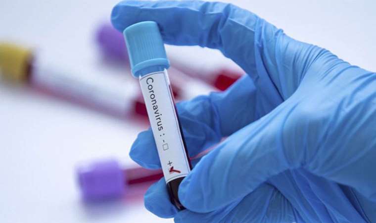 Bilim kurulu üyesinden ‘Covid-19’ uyarısı: ‘Kış döneminde yaygın ve baskın olacak’