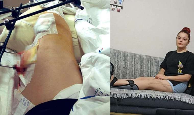 Eski sevgilisinin diz kapağından vurduğu kadının yardım çağrısı: ‘Öldürülmek istemiyorum’