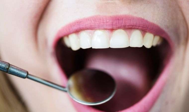 Acı dolu gülümsemelerden kurtulmak mümkün: Diş ağrısını hafifletiyor… Üstelik bir tutam pamuğa dökmek yeterli!