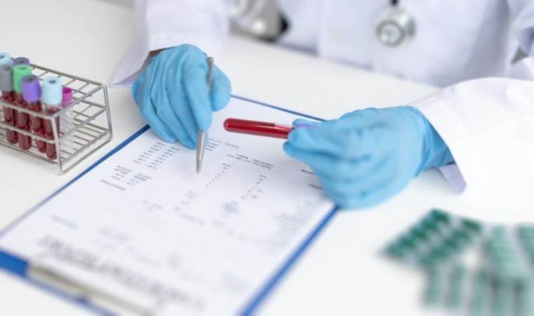 ‘Tekniker sıkıntısı yaşanıyor’