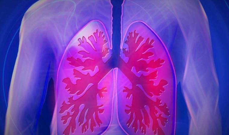 ‘Benzersiz’ moleküler tedavi hamlesi: Akciğer kanserini durdurmaya yardımcı olabilir