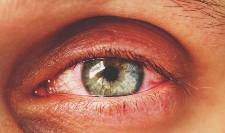 Yapay zeka göz sağlığında devrim yaratacak