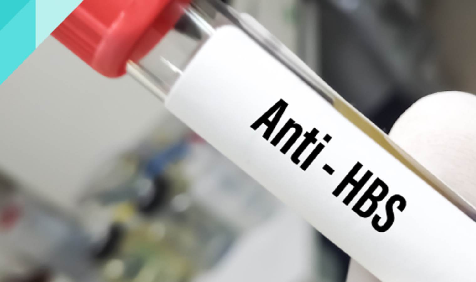 Anti HBS nedir? Anti HBS pozitif ne demek?