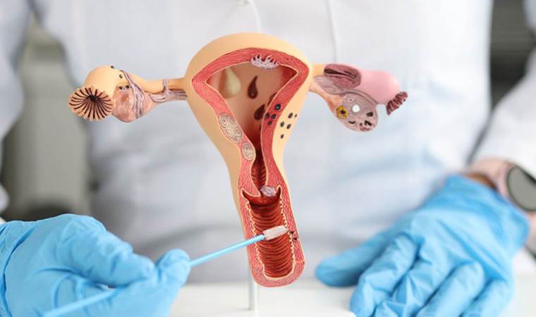 Uzmanı uyardı, 30 yaşından sonra her kadın bu riski taşıyor