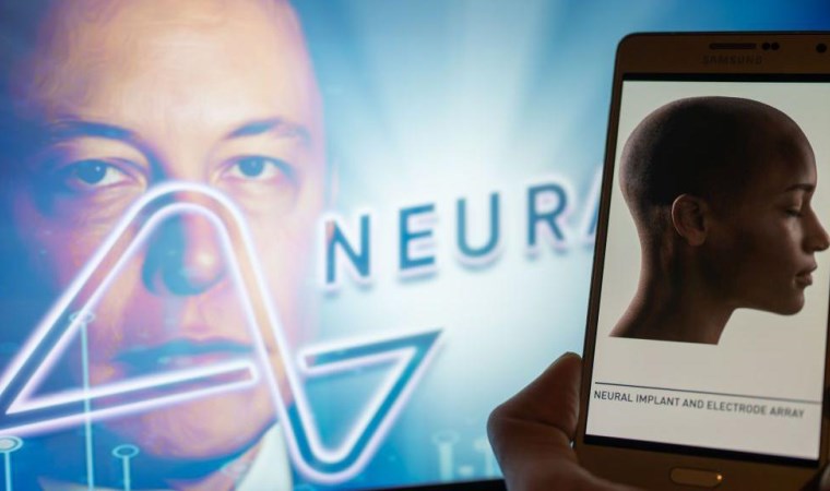 Elon Musk, kendisine ait Neuralink şirketinin ilk kez bir insanın beynine çip yerleştirdiğini duyurdu