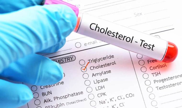 Uzmanından kolesterolü dengede tutmanın yolları