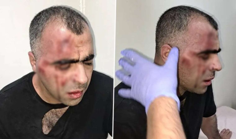 Belediye başkanının korumaları tarafından saldırıya uğramıştı: Gazeteciye saldırganlara ‘hakaret’ten hapis cezası