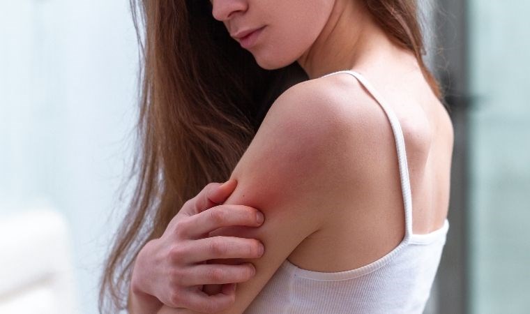 2 malzemeyi karıştırın egzamayı yatıştırın: Egzamaya elveda!