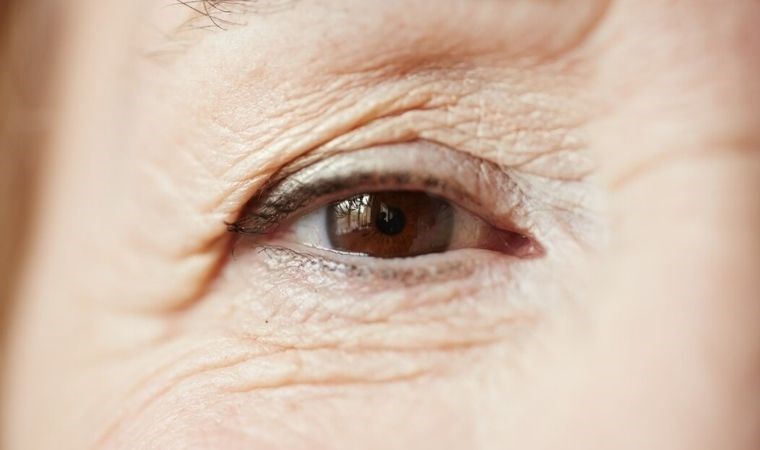 Kırışıklıklara karşı etkili tarif: Sadece üç malzeme ile kırışıklıklar yok olacak…