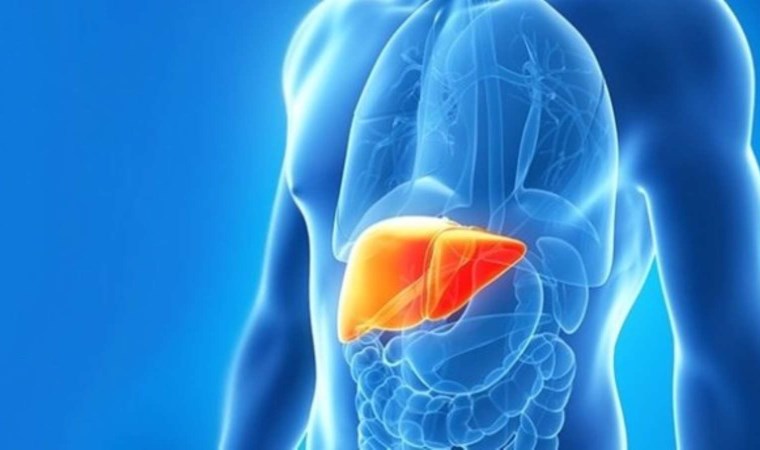 Bu belirtiler varsa dikkat: Karaciğer yağlanmanız olabilir