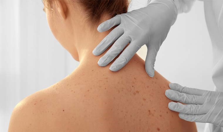 Bu belirtiler varsa dikkat: Dünyada en sık görülen kanser türü…