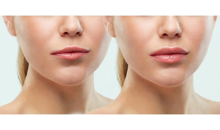 Dudaklarda dolgu etkisi yaratıyor! İşte evde dudak dolgunlaştırmak için 5 yöntem…