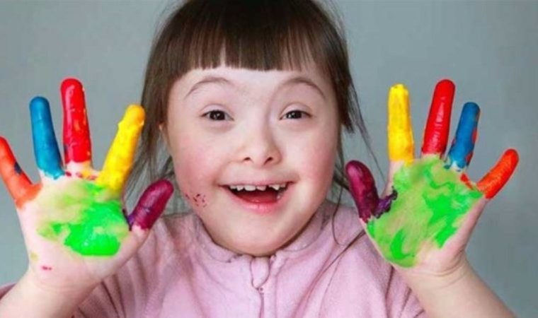 21 Mart Dünya Down Sendromu Farkındalık Günü: Down sendromu nedir, belirtileri nelerdir? Dünya Down Sendromu Farkındalık Günü nedir?
