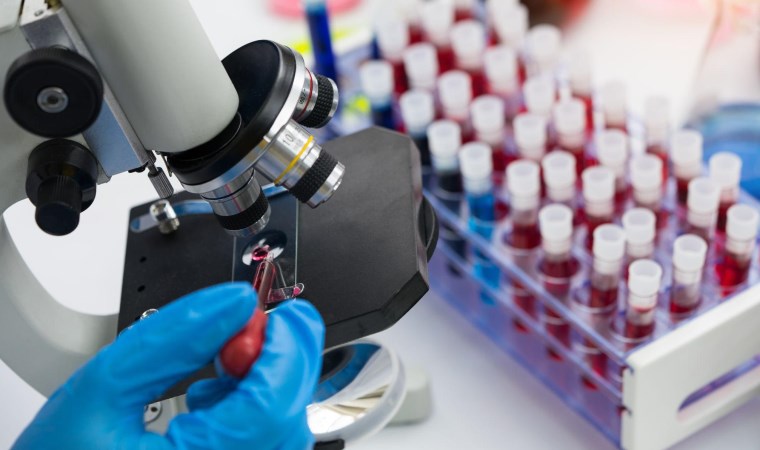 AIDS’te yeni tedavi umudu: HIV’i hücreden ayırma denemesi başarılı oldu