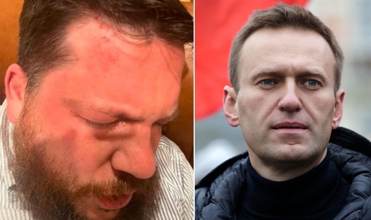 Navalni’ye yakınlığıyla biliniyordu: Çekiçli saldırı