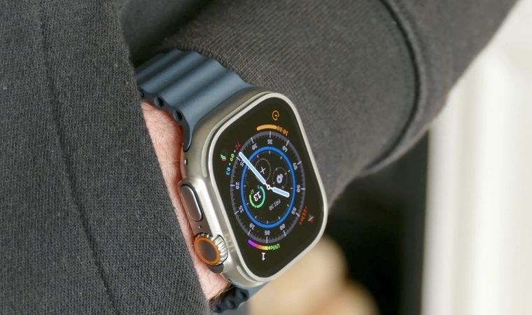 Apple Watch sorunu watchOS 10.4 ile çözüldü mü?