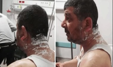 DP'li Ertan Küçükay duyurdu: Meclis üyesi adayına asitli saldırı! – Son Dakika Siyaset Haberleri | Cumhuriyet