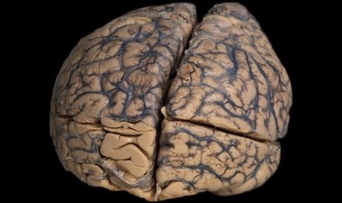 Akıl hastalıklarına ışık tutacak! 8 bin yıllık antik beyin…. – Son Dakika Bilim Teknoloji Haberleri | Cumhuriyet