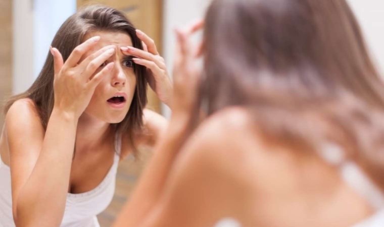 Sivilce izlerinden kurtulmak mümkün mü? Dermatologlar açıkladı…