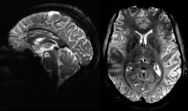 İnsan beyninin en net görüntüsü yayınlandı – Son Dakika Bilim Teknoloji Haberleri | Cumhuriyet