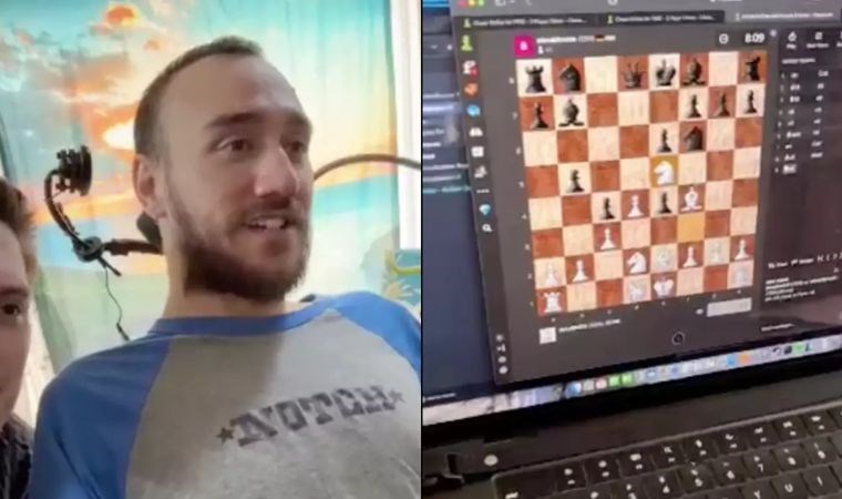 Elon Musk’ın beyin çipi, ilk kez arıza yaptı