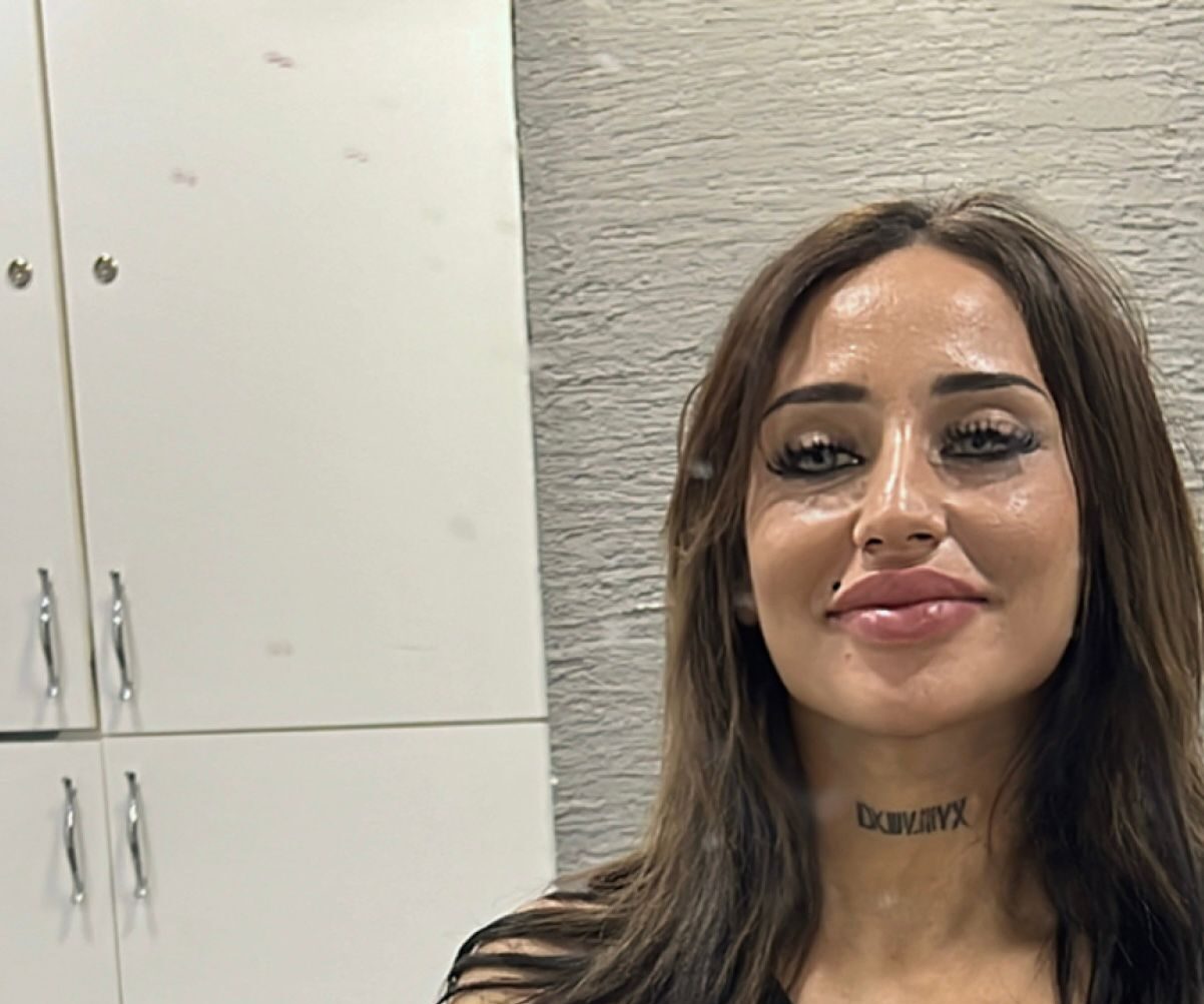 Melisa Tatlıarmut’un Sunduğu Estetik Hizmetler: Gözlerinizin Işıltısı