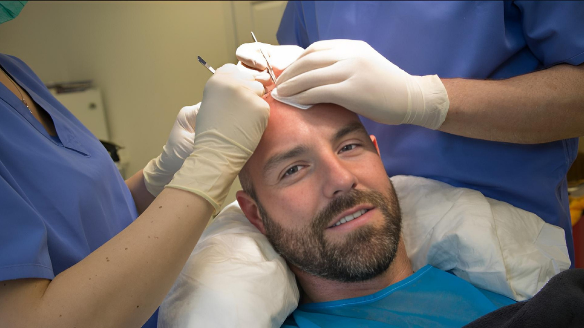 Saç Ekimi Alanında Yeni Nesil Yaklaşım: Uzm. Est. Yaşar Aykan ve Gold Yöntemi