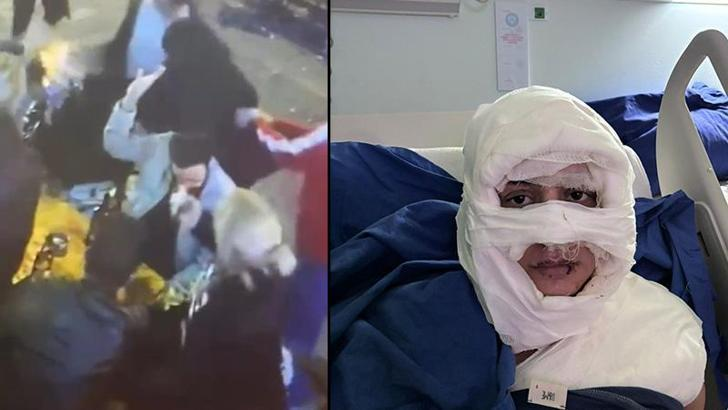 Kadıköy’de Kadına Yanıcı Madde Saldırısı Duruşması