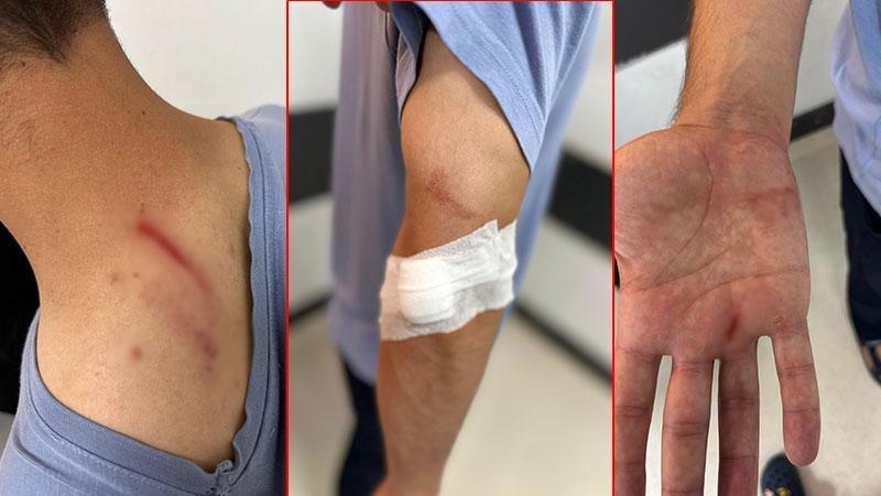 İlaç raporu tartışması hastanede şiddetle sonuçlandı
