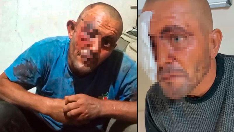 Dans videolarıyla tanınan zihinsel engelli genç saldırıya uğradı